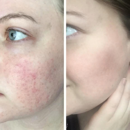 Silque Rewind Balm